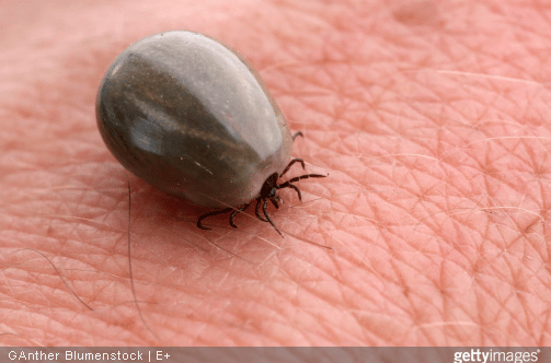 Maladie de Lyme : symptômes et prévention