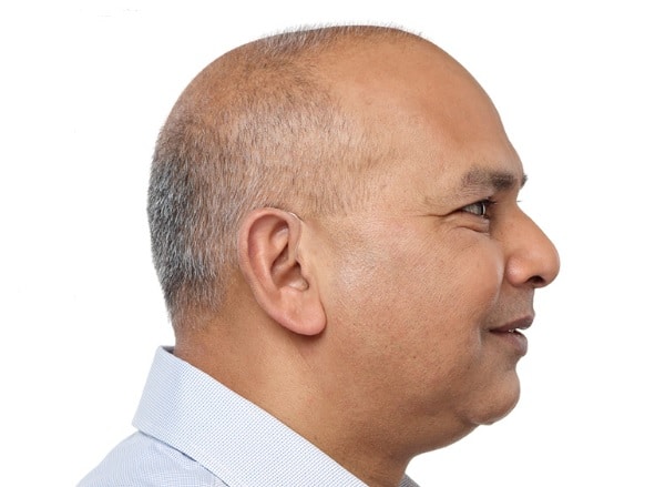 Homme qui porte un appareil auditif contour d'oreille invisible